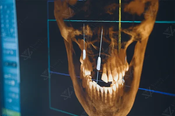 CBCT 3D dental imaging and cone beam CT scan Abu Dhabi