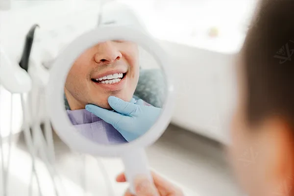 Smile makeover Hollywood Smile Abu Dhabi
