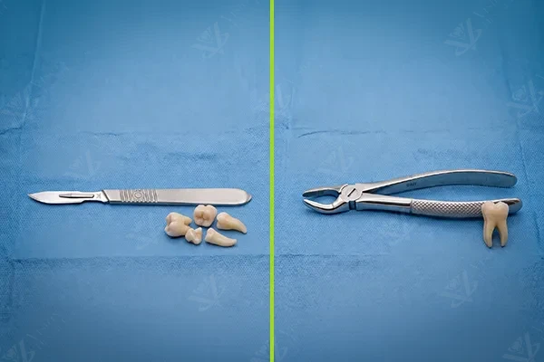 Surgical tooth extraction and wisdom tooth removal Abu Dhabi