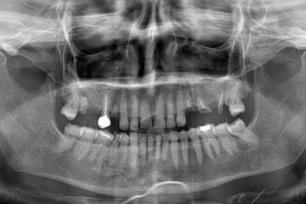 Before treatment — initial condition