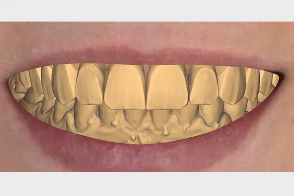 Digital smile design