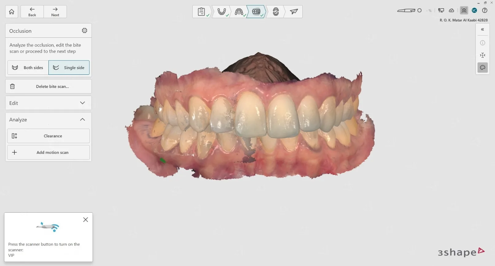 3Shape intraoral scanner — digital assessment before wisdom tooth extraction Abu Dhabi