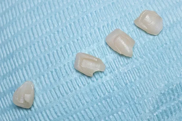 During treatment — porcelain restorations