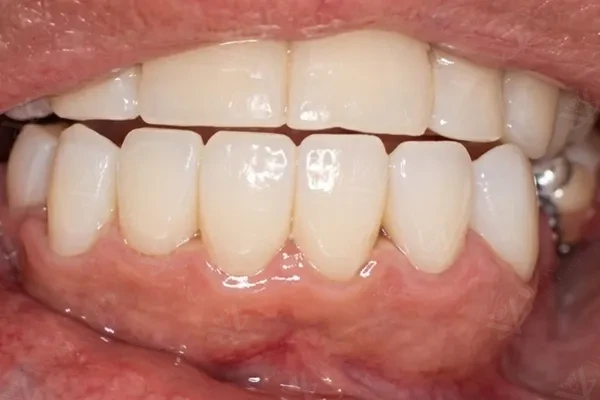After — final restoration result