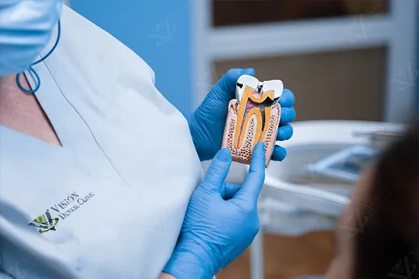 Root canal treatment endodontics Abu Dhabi